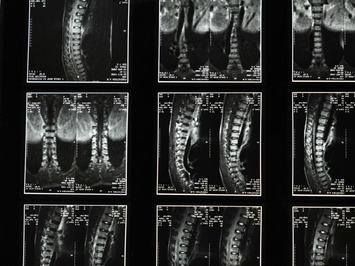 Scientific Error in Surah At-Tariq 86:6; Sperm Comes From the&nbsp;Spine